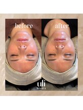 ウリ(uli beauty)/比較写真