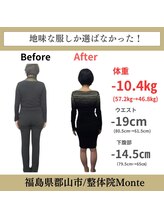 整体院 モンテ(monte)/before＆after