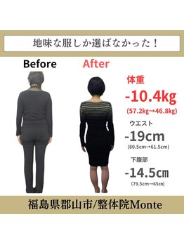 整体院 モンテ(monte)/before＆after
