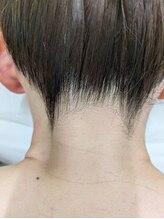 ブルーココア(BlueCocoa)/襟足脱毛1回目剃毛。