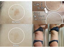 リンパケア専門店アンジーの雰囲気(しみケア美白毛穴・たるみ小顔・健康美ボディ♪スピード脱毛人気)