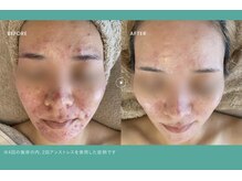 ミレラ(Mirela)の雰囲気(赤み・乾燥トラブルを即効鎮静!水光肌へ導くアンストレス◇)