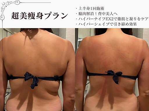 ラブミー 渋谷本店(LoveMe)｜ホットペッパービューティー