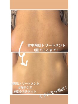 レストボディー(Rest Body)/背中陶肌トリートメント♪