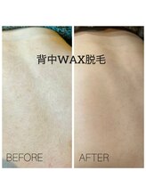 ココリ(CoCoRe)/背中wax