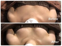 レクシートーキョー(LEXXXY TOKYO)/どこでも体験できないバストケア