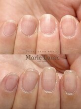 マリーロール 淀屋橋本店(Marie Laure)/自爪育成/深爪矯正/ネイルケア