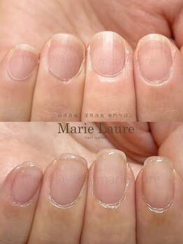 マリーロール 淀屋橋本店(Marie Laure)/自爪育成/深爪矯正/ネイルケア