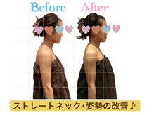 ルフレ(Rufure)/劇的ビフォーアフター♪