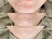 ウィル 二子新地(will)/艶玉肌ケア