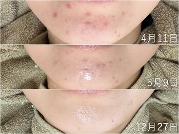 ウィル 二子新地(will)/艶玉肌ケア