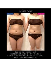 クロシェット(Clochette)/