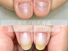 ル リアン 北浦和(le lien)/深爪育成(7ヶ月／8回)