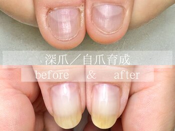 ル リアン 北浦和(le lien)/深爪育成(7ヶ月／8回)