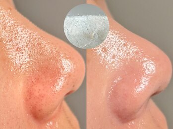 ルーナジェーナ(Luna llena)/