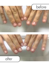 ピノ(pino)/◆深爪矯正＋自爪風仕上げ◆