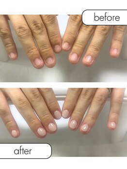 ピノ(pino)/◆深爪矯正＋自爪風仕上げ◆