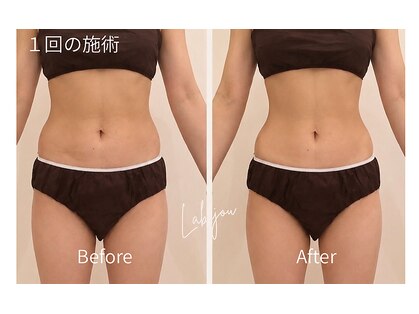 ラビジュー(Labijou)の写真