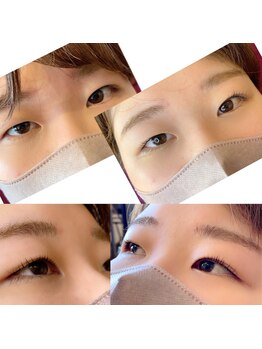 シャンティ(Shanti)/パリジェンヌラッシュリフト