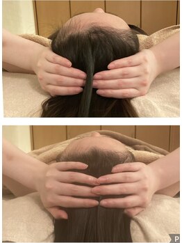 フルールドソレイユ(Fleur de Soleil)/頭も小さく額も綺麗なアーチに♪