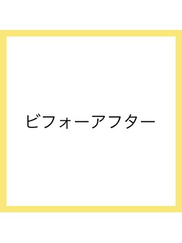 ランコント(rencontre)/肩こり/リンパマッサージ/痩身