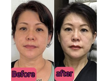 ノウ(nou)/小顔矯正/ヘッドスパ