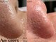 エムソエル(Am'soers)の写真