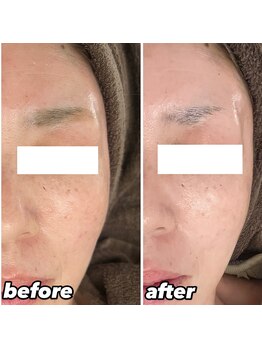 ヴィヴ コレビ(VIV COREBI)/一度でお悩み解決!