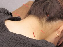 本多鍼灸整骨院なみき院の雰囲気（【人気の鍼施術】幅広いお悩みにも対応致します）