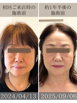 エテルニテ(eternite)/昔の自分とはおさらば！！