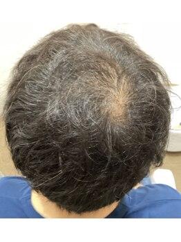 エルプラス(L+)/30代男性.１