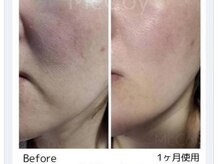 シェアリ(SHARY)の雰囲気（肌のキレイさは土台から★筋膜からケアするノンFスキンケア）