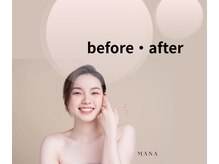 ソルツーサロン マナ(MANA)/ビフォーアフター