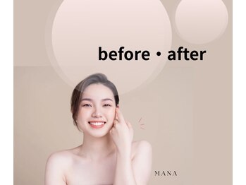 ソルツーサロン マナ(MANA)/ビフォーアフター