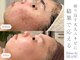 サロン ド ブラン アオヤマ(Salon de BLANC AOYAMA)の写真