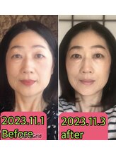 ノウ(nou)/小顔矯正／ヘッドスパ