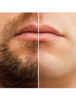 フラッフィー(FRUFFY)/髭WAX脱毛［三島/眉毛/耳かき］