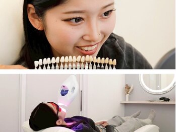 ホワイトニング美白ラボ 筑西店(ホワイトニング美白LAB)の写真/茨城県西エリア稀少"歯科提携美白ホワイトニング"導入店！高コスパの結果重視セルフホワイトニング♪