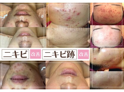 エステ ラミ(Esthe' l'ami)の写真