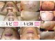 エステ ラミ(Esthe' l'ami)の写真