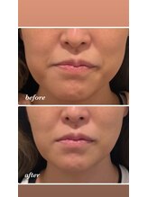 アリミリサロン(A.Rimi.Ri salon)/レッドショット