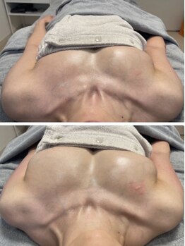 スマイルクルー(SmileClue)/ビフォーアフター症例