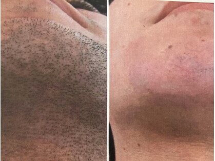 ナウフィールドの写真