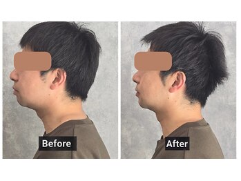 ととのえる。/ビフォーアフター