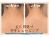大好評の為、継続限定MENU◎背中・うなじ・襟足エステシェービング