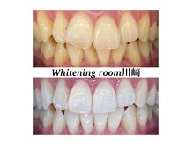 ホワイトニングルーム 川崎店(WhiteningRoom)の雰囲気（歯科提携のホワイトニングだから初回から驚きの白さに！）