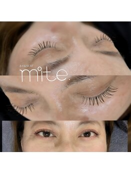 ミテ(mite.)/120本イメージ