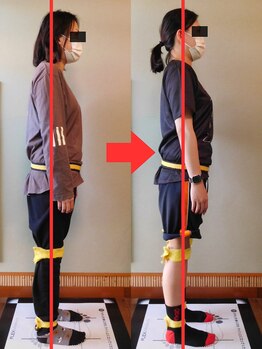 チャラク(charaku)/【30代K様：全身矯正+猫背矯正】