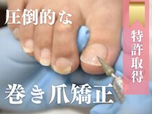 巻き爪専門ラボ 豊田店