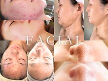 サロン ガトレオ(GatoLeo)の雰囲気（大人の為の品質にこだわった自然派ノンケミカルハーブピーリング）